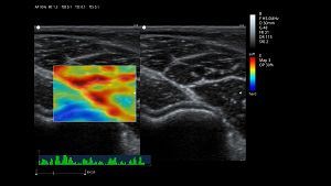 Elastic imaging(001)
