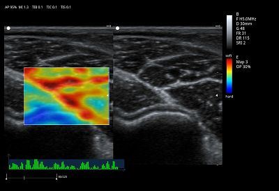 Elastic Imaging(001)
